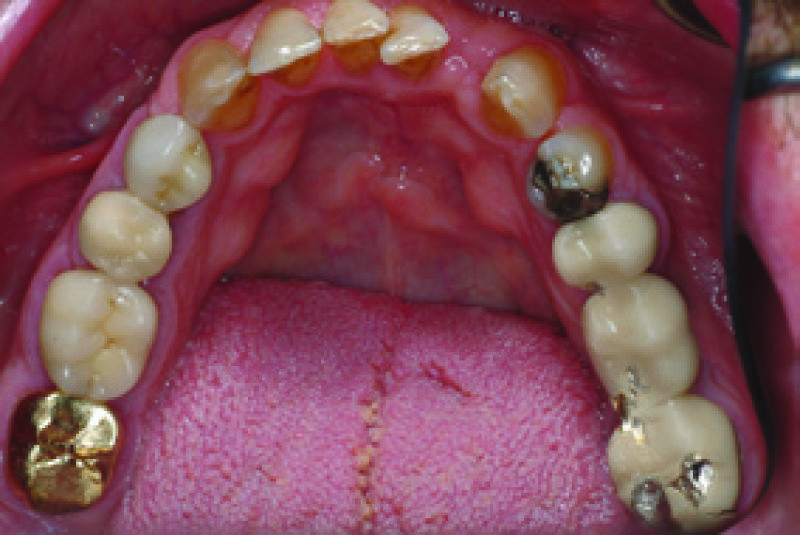 OLYMPUS DIGITAL DENTAL CAMERA KIT Intraoral Dental Cameras Aluro