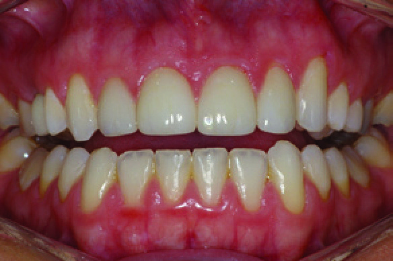 OLYMPUS DIGITAL DENTAL CAMERA KIT Intraoral Dental Cameras Aluro Equipment