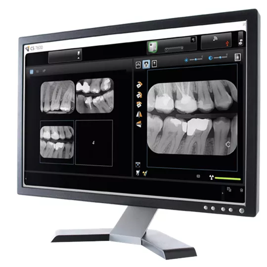 Aluro Dental Equipment Suppliers | CARESTREAM DENTAL CS7600 IMAGING PLATE SYSTEM