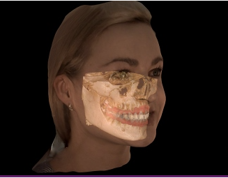 Image generated from a CBCT 3D Scan